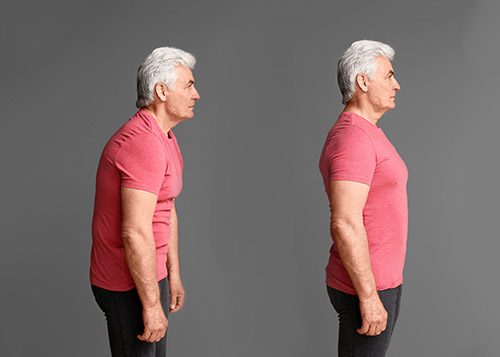 Posture assessment with Dr Marcello